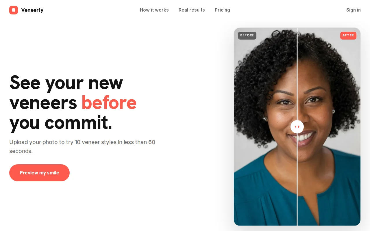Veneerly – See your own face with veneers before you commit